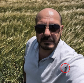Tarlada selfi yaparken üzerinde kene olduğu fark etti
